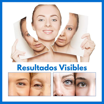 Botox Stock Solution Suero Antiarrugas™