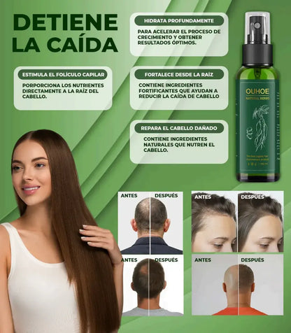 Spray Para Crecer El Pelo OUHOE